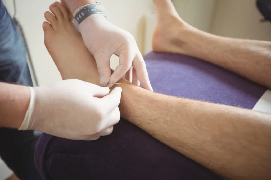 Tout savoir sur une operation du canal tarsien, un patient nous raconte